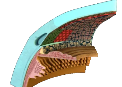 Medical VR training